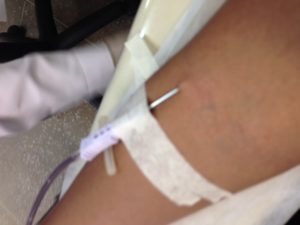 doação-de-sangue-agulha